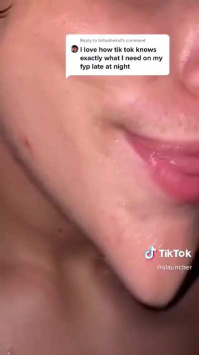 What is this bro