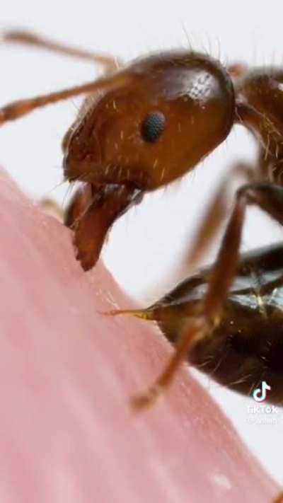 a cool up close shot of an ant bite ?