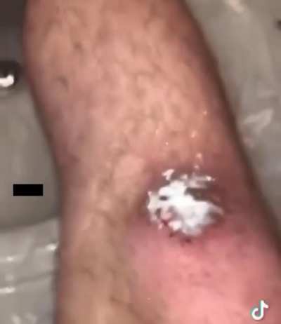 Major Physical Cringe ?