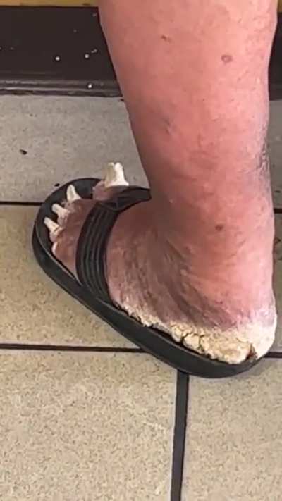 ? it looks itchy enough, btw can someone tell me what is this ?