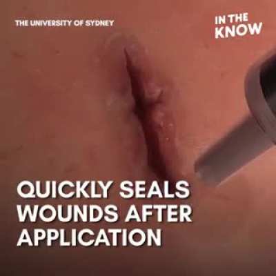 An biomedical and bio absorbable adhesive that helps is closing wounds instantly.