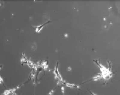 Time-Lapse Footage Of Neurons Making New Connection To Other Neurons In the Brain. This Is What Thoughts Look Like