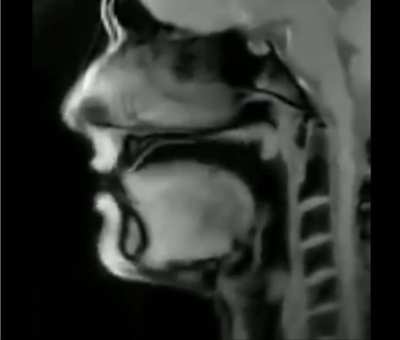 ? An MRI of a person talking.