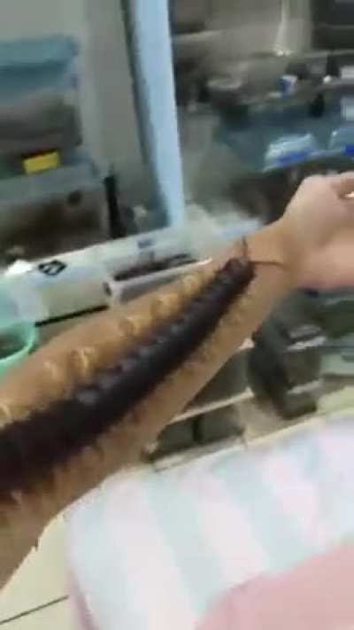 ? This giant centipede crawling the length of this man’s arm