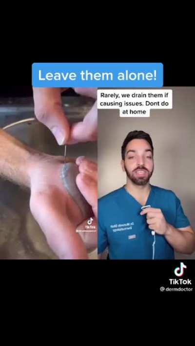Wait until the end