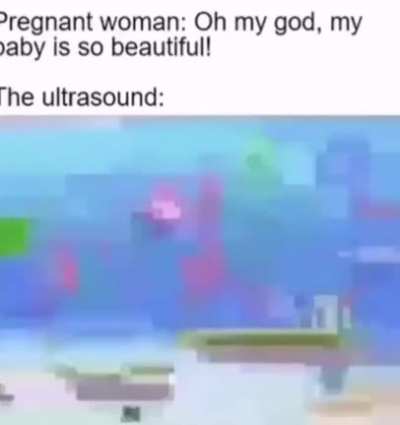 It's a boy