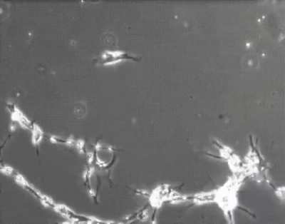 ? Brain cells in a culture dish trying to form connections with each other. Bright spots are the neuron nuclei. We have 100 billion of these in our brain. By Lex Fridman.