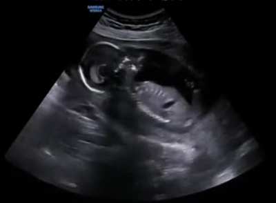 So much for not shaking the baby. What happens to a fetus when a mother laughs.