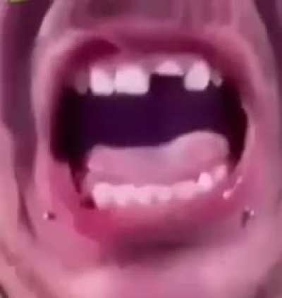 ?