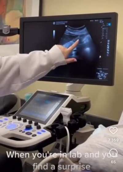 Girl found out she’s pregnant during a school lab ?