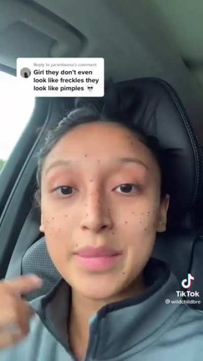 girl gets freckles tattooed on her face to make herself look "unique"